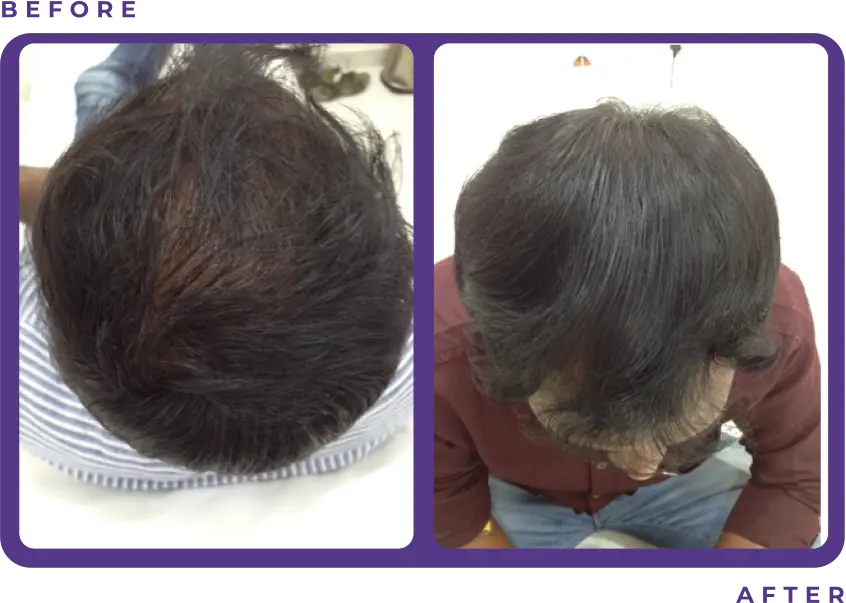 Before and After