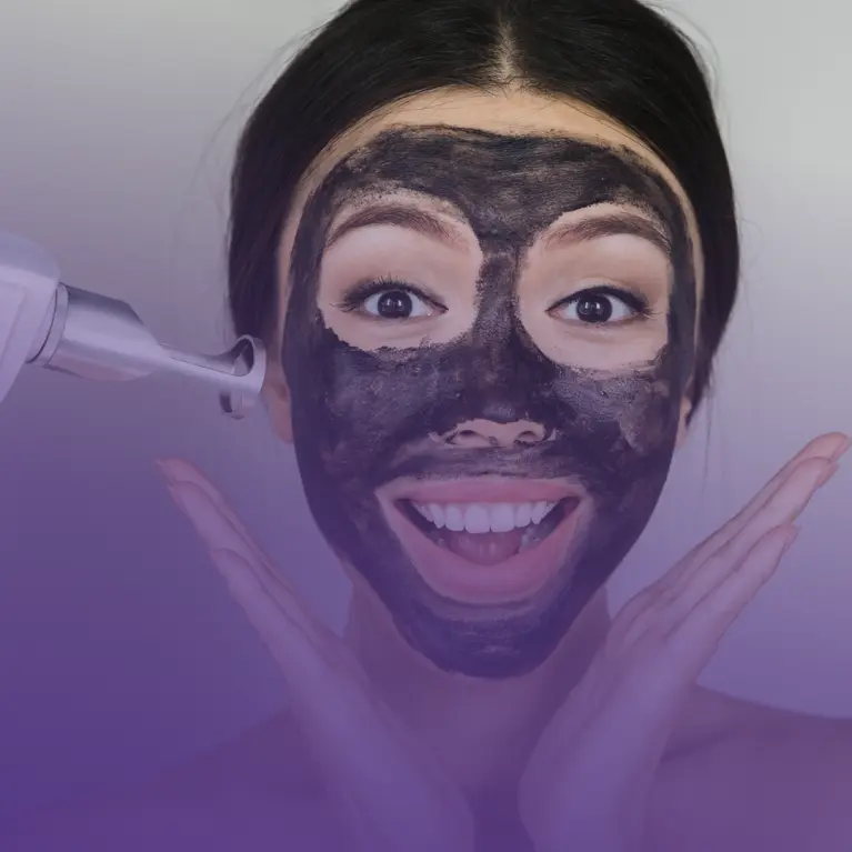 Carbon Laser Peel Treatment