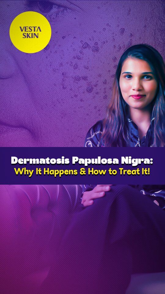 Noticing tiny dark bumps on your skin? It could be Dermatosis Papulosa Nigra (DPN)!

💡 Discover why it happens & the best treatments to achieve smooth, blemish-free skin. Watch now!

📍 Visit us at: Third Floor, Villa, 12/26, Coats Rd, T. Nagar, Chennai, Tamil Nadu 600017
📞 Call: 7709393369
🌐 www.vestaskin.com

#dpntreatment #flawlessskin #skinrejuvenation #skincare #VestaSkinClinic