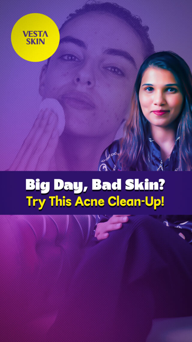 Big day ahead but bad skin holding you back? 😟 Say hello to clear, confident skin with our ultimate acne clean-up! ✨ Book your appointment today!

📍 Third Floor, Villa, 12/26, Coats Rd, T. Nagar, Chennai
📞 7709393369 | 🌐 www.vestaskin.com

#ClearSkin #AcneFreeGlow #vestaskin